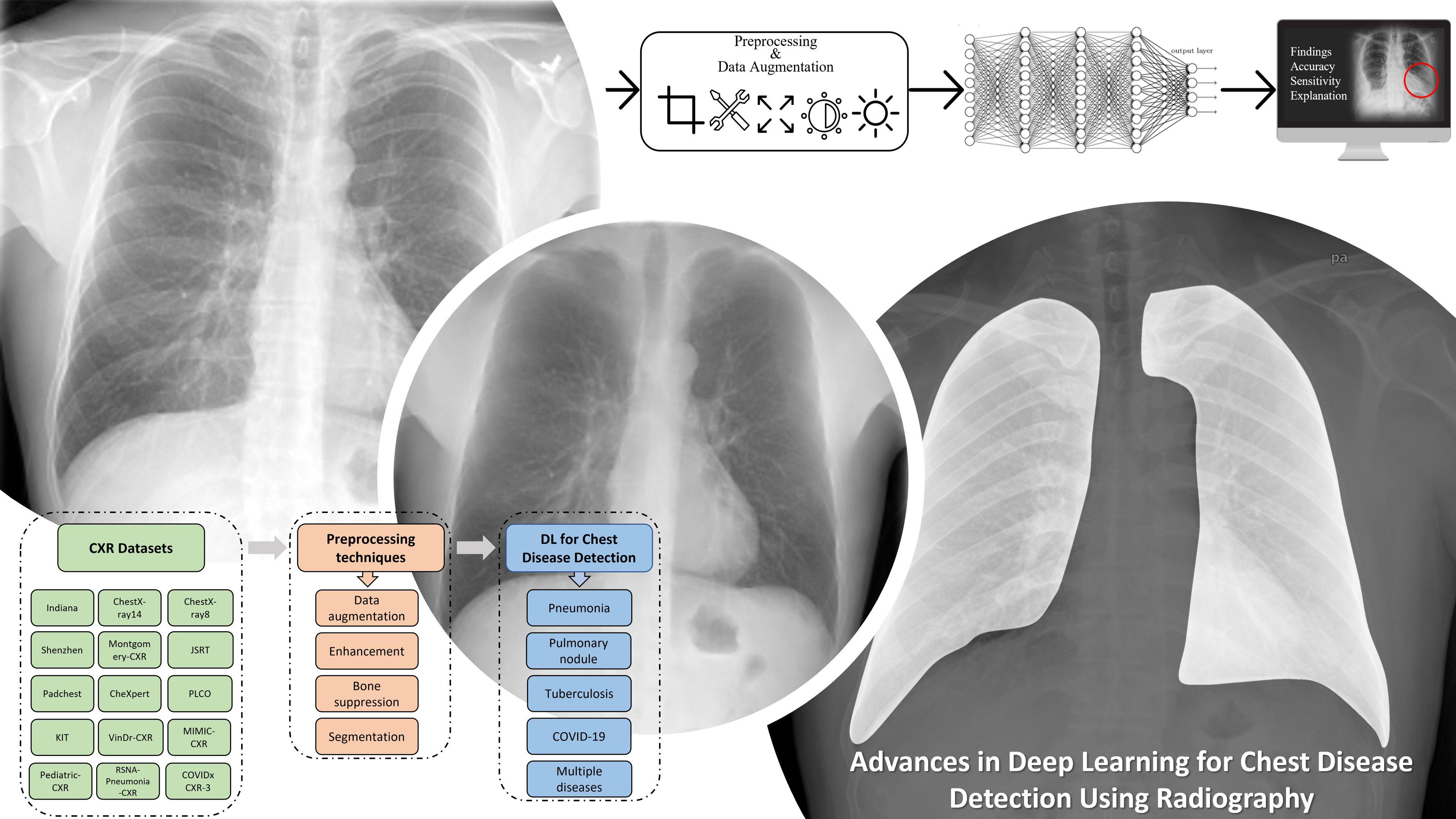 Diagnostics | Free Full-Text | A Review of Recent Advances in Deep ...